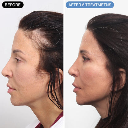 Curadose™ Scalp Care System