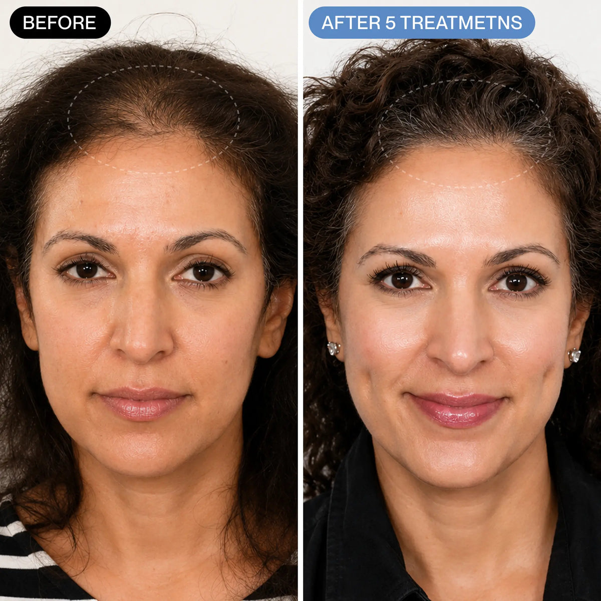 Curadose™ Scalp Care System