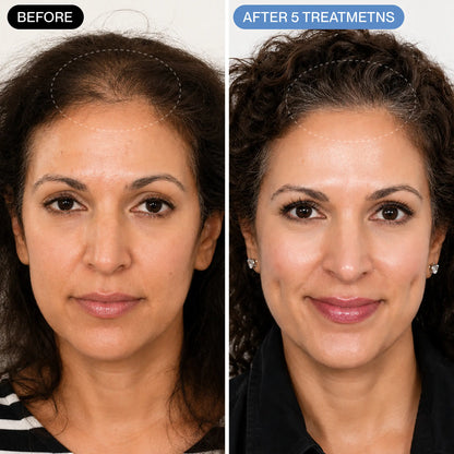 Curadose™ Scalp Care System