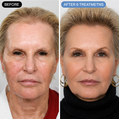 Curadose™ Scalp Care System