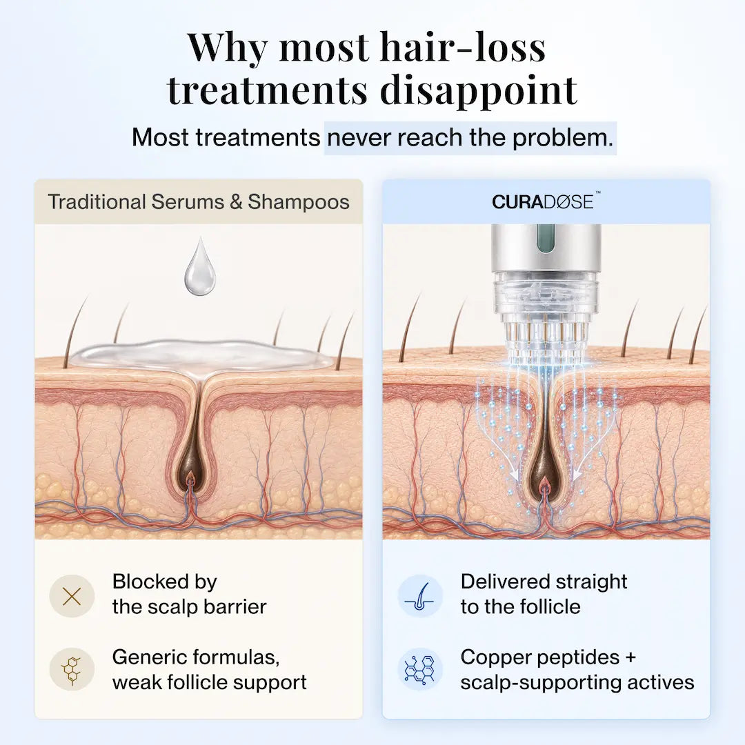 Curadose™ Scalp Care System